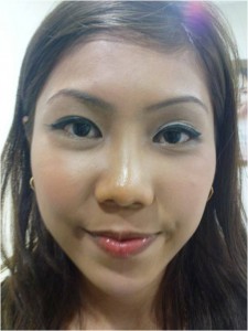 facial remodelling after photo