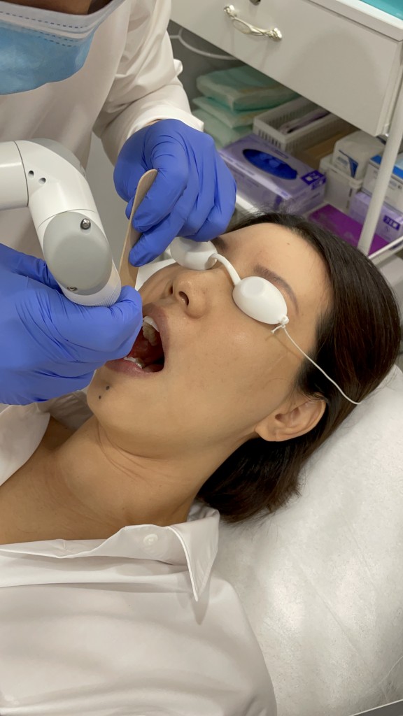 Fotona 5D Laser Lift starts off with treating inner oral cavity.