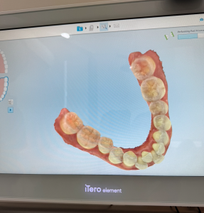 3D scans of my teeth. Very cool!