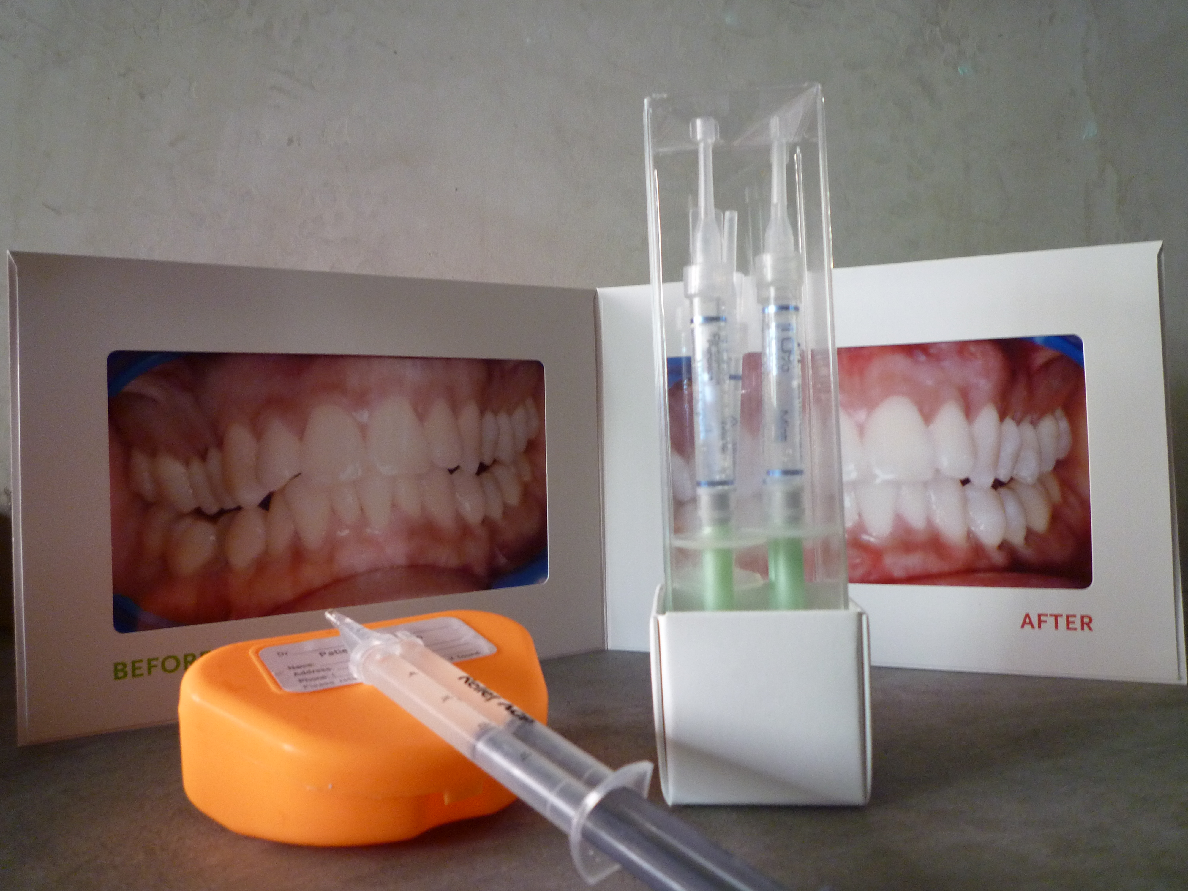 laser teeth whitening take home kit