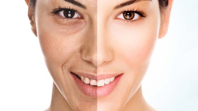 Skin laser anti aging treatment