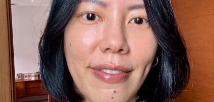 Skin is skin-ning after 4 sessions of Bio-collagen.